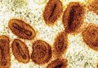 Scientists charged with bringing deactivated mpox virus into US, lying to authorities