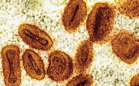 Scientists charged with bringing deactivated mpox virus into US, lying to authorities