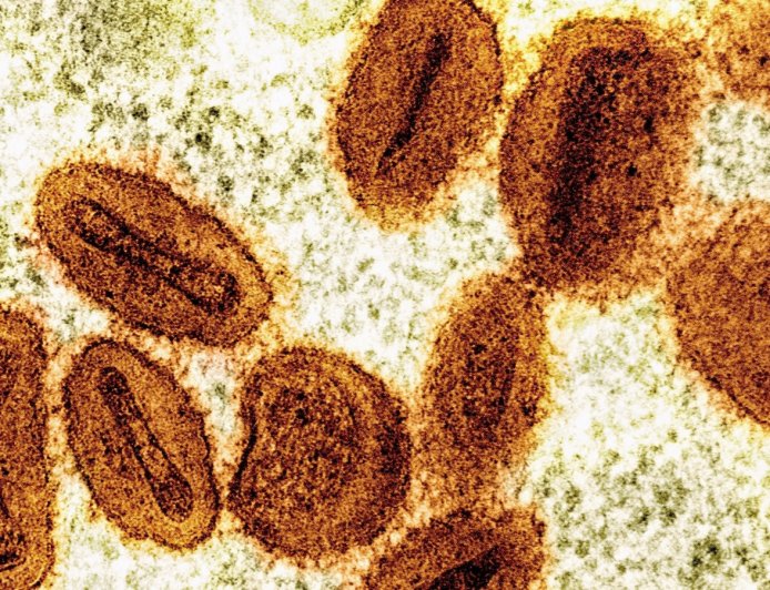 Scientists charged with bringing deactivated mpox virus into US, lying to authorities
